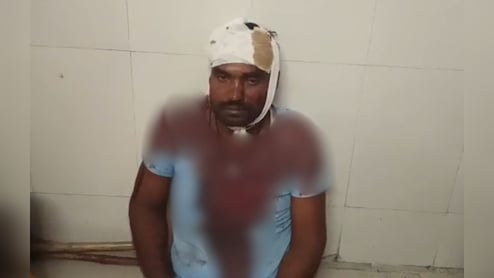 मछली के लिए खूनी संघर्ष! दोनों गुटों में लाठी-डंडों और कुल्हाड़ी से मारपीट; 12 गंभीर घायल