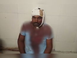 मछली के लिए खूनी संघर्ष! दोनों गुटों में लाठी-डंडों और कुल्हाड़ी से मारपीट; 12 गंभीर घायल मछली के लिए खूनी संघर्ष! दोनों गुटों में लाठी-डंडों और कुल्हाड़ी से मारपीट; 12 गंभीर घायल