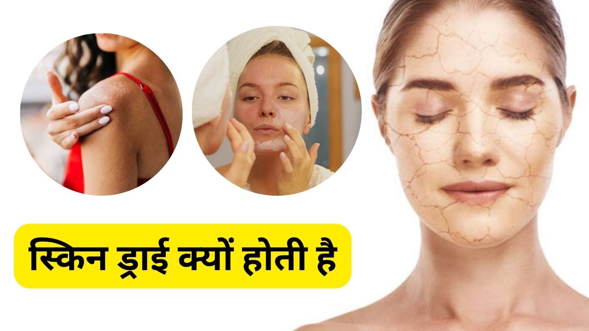 किस विटामिन की कमी से ड्राई होने लगती है स्किन? | Which Vitamin The Skin Starts Becoming Dry