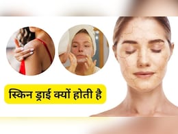 किस विटामिन की कमी से ड्राई होने लगती है स्किन? | Which Vitamin The Skin Starts Becoming Dry किस विटामिन की कमी से ड्राई होने लगती है स्किन? | Which Vitamin The Skin Starts Becoming Dry