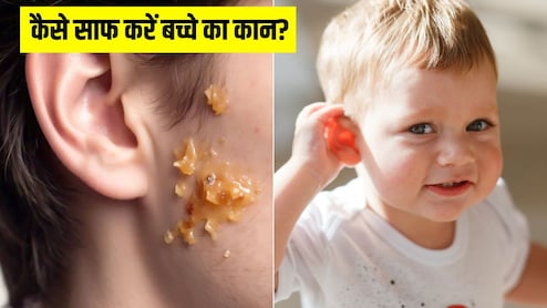 बच्चे के कान का मैल कैसे साफ करें? डॉक्टर ने बताया इस तरीके से खुद पिघलकर बाहर आ जाएगी गंदगी