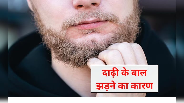 मैं अपनी दाढ़ी के बालों को झड़ने से कैसे रोकूं? दाढ़ी के बालों को घना कैसे करें, आज से यह कार्य करें