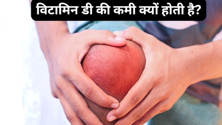 विटामिन डी की कमी के 5 लक्षण, कही आप तो नहीं बन रहे शिकार