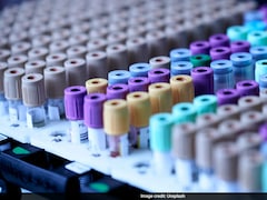 AIIMS Introduces In-House, Free Drug-Level Tests For Epilepsy Patients