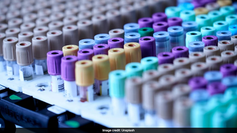 AIIMS Introduces In-House, Free Drug-Level Tests For Epilepsy Patients