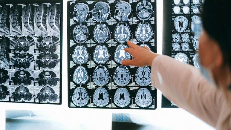 New WHO Report Highlights Growing Burden Of Neurological Disorders New WHO Report Highlights Growing Burden Of Neurological Disorders