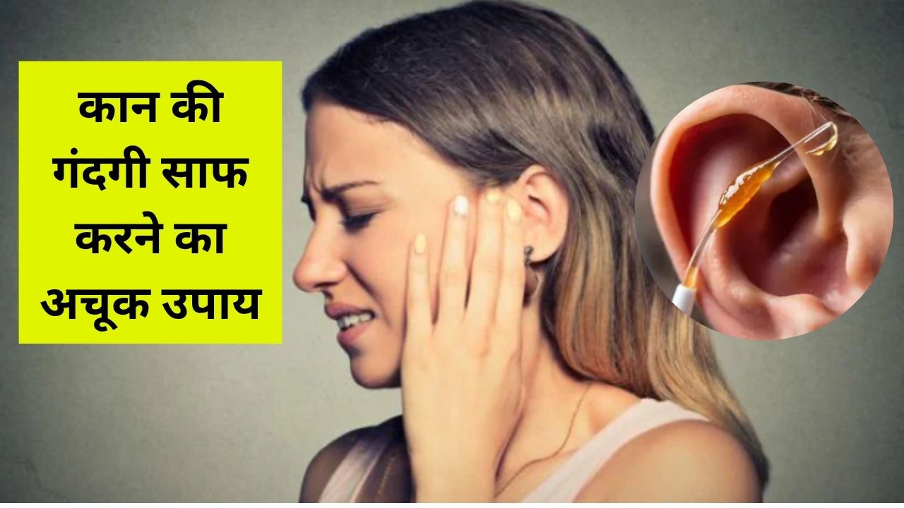 कान के अंदर जमा पीला कबाड़ कैसे साफ करें? अपनाएं ये 5 घरेलू आसान तरीके, खुद ही निकलने लगेगा बाहर