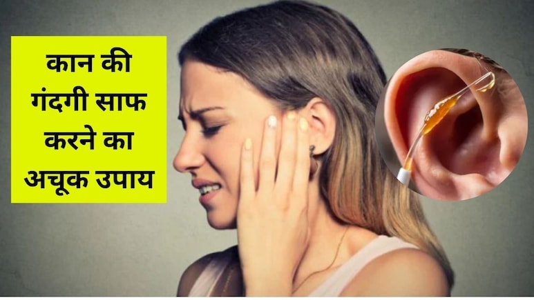 कान की गंदगी कैसे निकालें? इन 5 घरेलू तरीकों में से अपनाएं कोई भी, चुटकियों में साफ हो जाएगा कान