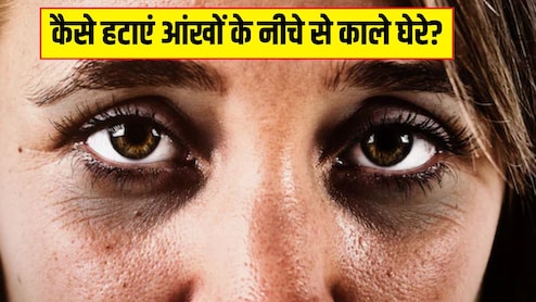 चाय पत्ती, कॉफी या खीरा, किससे जल्दी साफ हो सकते हैं Dark Circles? स्किन की डॉक्टर से जान लें