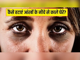 चाय पत्ती, कॉफी या खीरा, किससे जल्दी साफ हो सकते हैं Dark Circles? स्किन की डॉक्टर से जान लें चाय पत्ती, कॉफी या खीरा, किससे जल्दी साफ हो सकते हैं Dark Circles? स्किन की डॉक्टर से जान लें