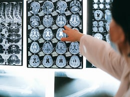 Neurologist Explains Why Invisible Symptoms Make Autoimmune Brain Conditions Harder To Recognise