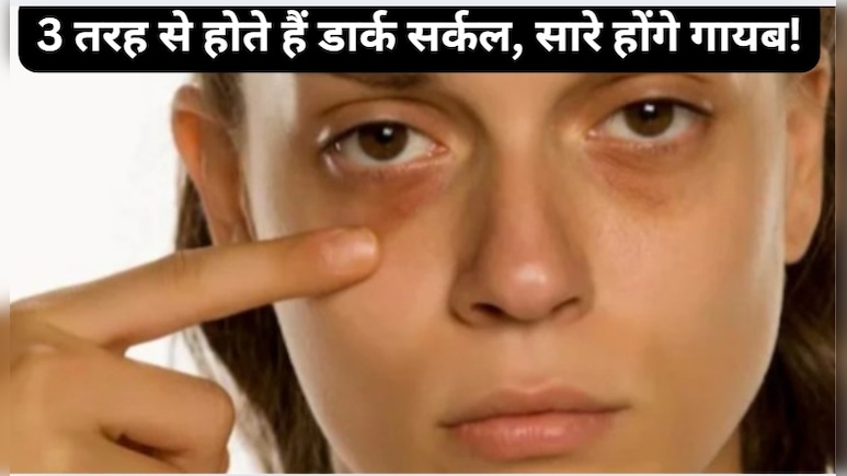 डार्क सर्कल कितने प्रकार के होते हैं? यहां जानें आपको कौन से हैं?