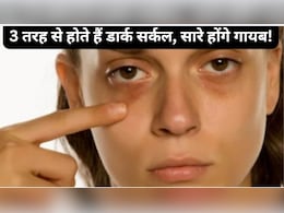 डार्क सर्कल कितने प्रकार के होते हैं? यहां जानें आपको कौन से हैं? डार्क सर्कल कितने प्रकार के होते हैं? यहां जानें आपको कौन से हैं?