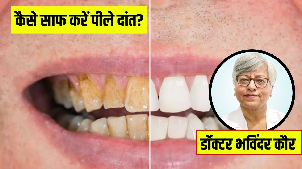 क्या नीम की दातून से पीले दांत सफेद हो जाते हैं? डेंटल सर्जन ने बताया Teeth Whitening का नुस्खा