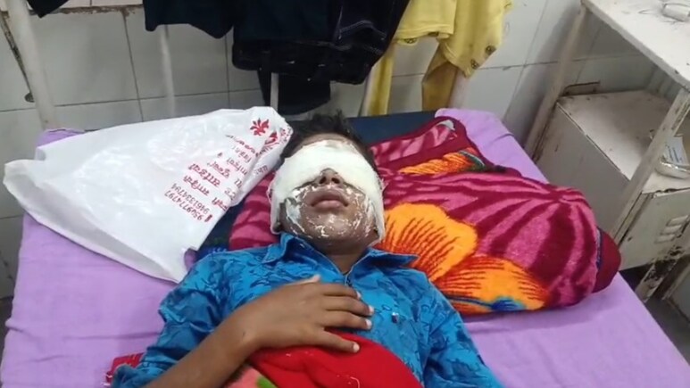 Rajasthan: घर में अकेला था 10 साल का मासूम, हाथ में फट गया सुतली बम; जोरदार धमाका सुनकर पहुंचे लोग