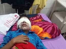 Rajasthan: घर में अकेला था 10 साल का मासूम, हाथ में फट गया सुतली बम; जोरदार धमाका सुनकर पहुंचे लोग Rajasthan: घर में अकेला था 10 साल का मासूम, हाथ में फट गया सुतली बम; जोरदार धमाका सुनकर पहुंचे लोग