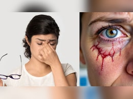 Exclusive:अचानक अंधा बना सकती है अनकंट्रोल Diabetes, जानें डायबिटिक रेटिनोपैथी के शुरुआती लक्षण, बचाव के उपाय Exclusive:अचानक अंधा बना सकती है अनकंट्रोल Diabetes, जानें डायबिटिक रेटिनोपैथी के शुरुआती लक्षण, बचाव के उपाय