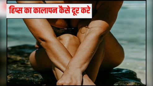 हिप्स के कालेपन को कैसे दूर करें? अरोमा थेर‍ेप‍िस्‍ट मनोज दास ने कहा इन 4 चीजों से तैयार लोशन रोज लगाएं, सारी टैन‍िंग हो जाएगी दूर