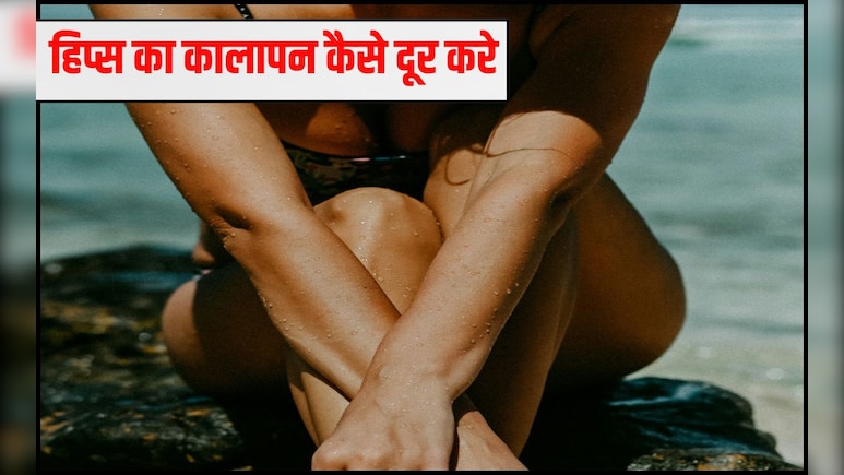 हिप्स के कालेपन को कैसे दूर करें? अरोमा थेरेपिस्ट मनोज दास ने कहा इन 4 चीजों से तैयार लोशन रोज लगाएं, सारी टैनिंग हो जाएगी दूर हिप्स के कालेपन को कैसे दूर करें? अरोमा थेरेपिस्ट मनोज दास ने कहा इन 4 चीजों से तैयार लोशन रोज लगाएं, सारी टैनिंग हो जाएगी दूर
