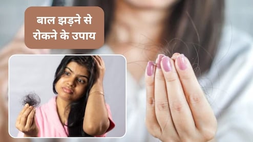 बालों का झड़ना कैसे रोकें, डॉक्टर ने बताया 21 दिनों तक अपनाएं ये 5 टिप्स, फिर देखें रिजल्ट