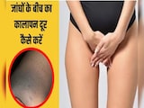 प्राइवेट पार्ट के कालेपन को कैसे साफ करें? प्राइवेट पार्ट पर क्या लगाना चाहिए डॉक्टर से जानिए प्राइवेट पार्ट के कालेपन को कैसे साफ करें? प्राइवेट पार्ट पर क्या लगाना चाहिए डॉक्टर से जानिए