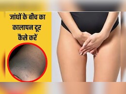 प्राइवेट पार्ट के कालेपन को कैसे साफ करें? प्राइवेट पार्ट पर क्या लगाना चाहिए डॉक्टर से जानिए प्राइवेट पार्ट के कालेपन को कैसे साफ करें? प्राइवेट पार्ट पर क्या लगाना चाहिए डॉक्टर से जानिए