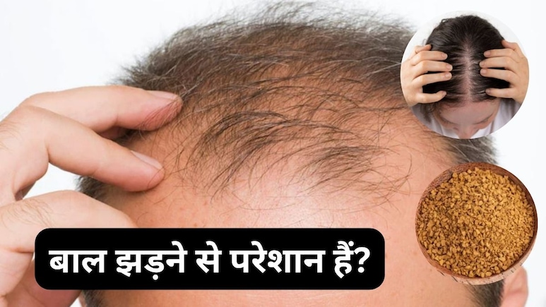 Hair Fall: गंजे सिर पर उग आएंगे नए बाल, बस इन छोटे-छोटे दानों का करके देखें इस्तेमाल