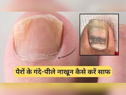 पैरों के गंदे-पीले नाखूनों को कैसे करें साफ? जानिए आसानी से सफाई करने की टिप्स, आ जाएगी चमक पैरों के गंदे-पीले नाखूनों को कैसे करें साफ? जानिए आसानी से सफाई करने की टिप्स, आ जाएगी चमक