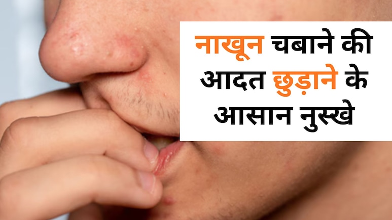 हजार कोशिशों के बाद भी नाखून चबाने की नहीं छूट रही है आदत, जान लीजिए इससे होने वाले 5 बड़े नुकसान हजार कोशिशों के बाद भी नाखून चबाने की नहीं छूट रही है आदत, जान लीजिए इससे होने वाले 5 बड़े नुकसान