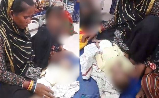 Sunken Eyes, Frail Skin: 4-Month-Old Dies Of Malnutrition In Madhya Pradesh