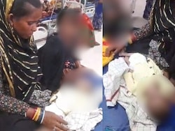 Sunken Eyes, Frail Skin: 4-Month-Old Dies Of Malnutrition In Madhya Pradesh