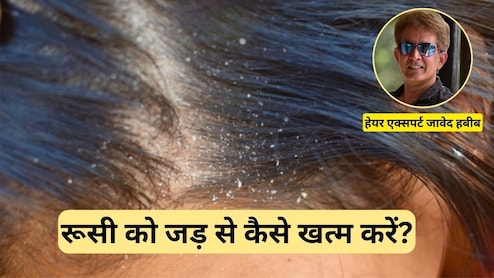 रूसी को जड़ से कैसे खत्म करें? हेयर एक्‍सपर्ट जावेद हबीब ने बताया एक दिन में डैंड्रफ कैसे दूर करें
