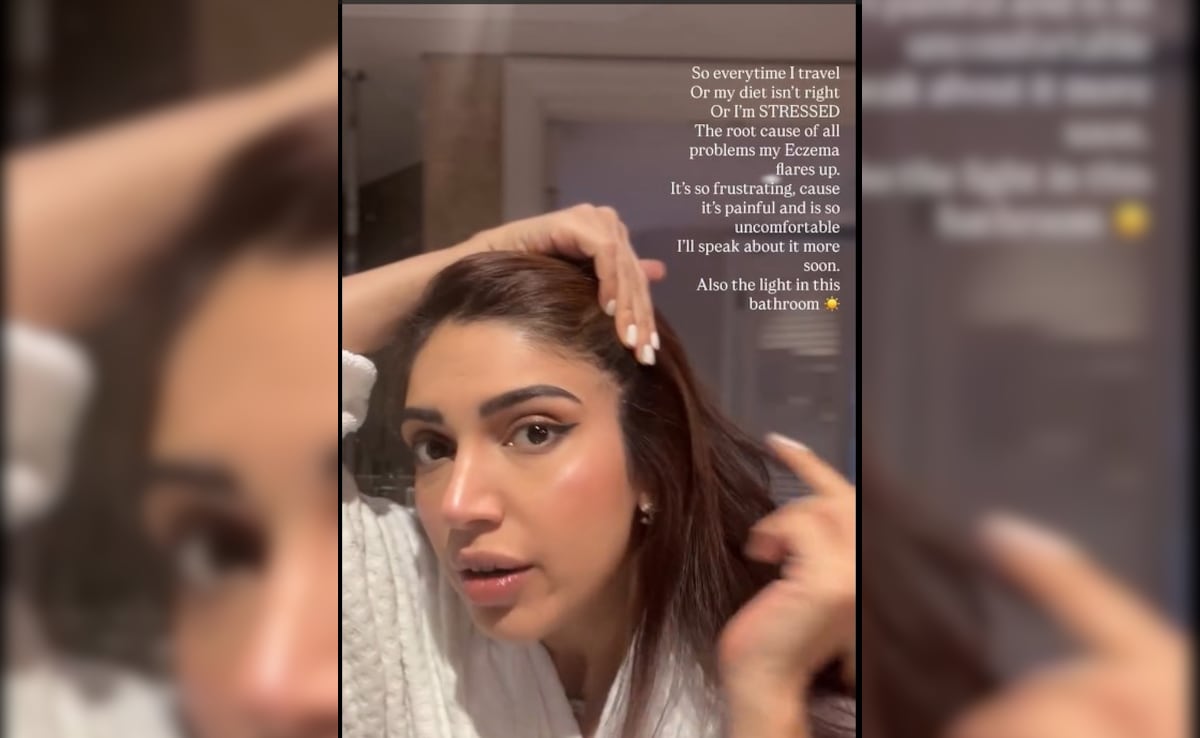 Bhumi Pednekar talks about her skin condition. Photo: Instagram/bhumisatishpednekkar Bhumi Pednekar talks about her skin condition. Photo: Instagram/bhumisatishpednekkar
