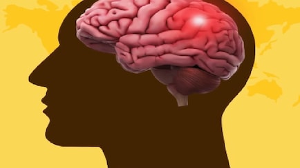 7 Symptoms Of Mini-Stroke That You Should Know