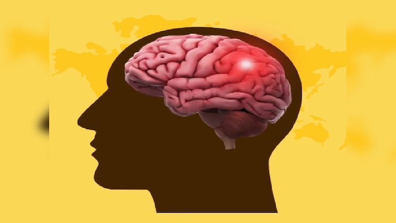 World Stroke Day 2025: ब्रेन स्ट्रोक का खतरा घटाना है तो अपनाएं ये आदतें, इन गलतियों से रहें दूर World Stroke Day 2025: ब्रेन स्ट्रोक का खतरा घटाना है तो अपनाएं ये आदतें, इन गलतियों से रहें दूर