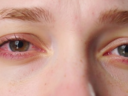 AQI 500 पार, आंखों में जलन? डॉक्टर ने बताए पॉल्यूशन से आंखों को बचाने के 6 आसान तरीके