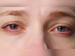 दिल्ली की जहरीली हवा से आंख की 50% तक बढ़ी समस्या दिल्ली की जहरीली हवा से आंख की 50% तक बढ़ी समस्या