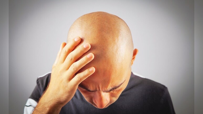 क्या बार-बार गंजे होने से बाल घने और काले आते हैं? ये रही इसके पीछे की सच्चाई