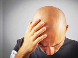 क्या बार-बार गंजे होने से बाल घने और काले आते हैं? ये रही इसके पीछे की सच्चाई क्या बार-बार गंजे होने से बाल घने और काले आते हैं? ये रही इसके पीछे की सच्चाई