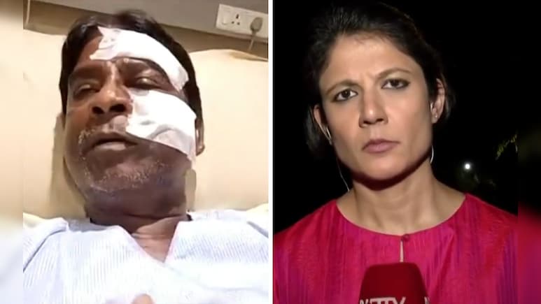 हमलावरों ने कहा कि हम दीदी के आदमी...बंगाल में अपने ऊपर हुए हमले पर BJP सांसद ने क्या कुछ बताया