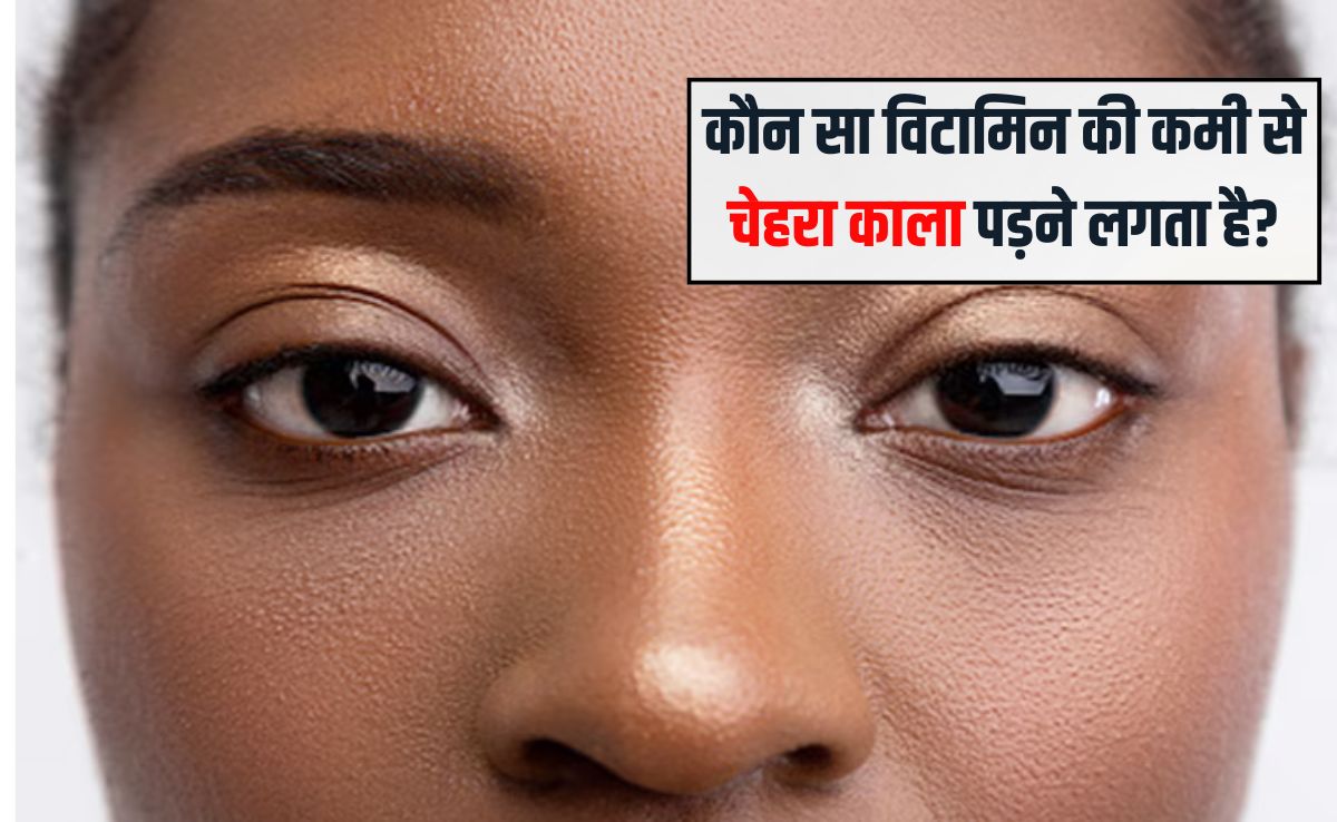 कौन सा विटामिन की कमी से चेहरा काला पड़ने लगता है? चेहरे पर चमक क्या खाने से आती है, जान‍िए यहां पर
