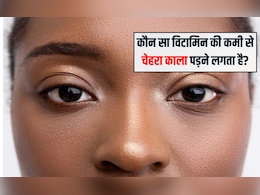 कौन सा विटामिन की कमी से चेहरा काला पड़ने लगता है? चेहरे पर चमक क्या खाने से आती है, जानिए यहां पर कौन सा विटामिन की कमी से चेहरा काला पड़ने लगता है? चेहरे पर चमक क्या खाने से आती है, जानिए यहां पर