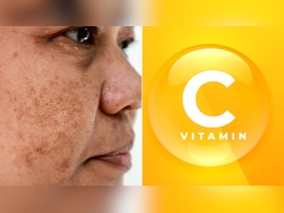 झाइयों के लिए Vitamin C के कैप्सूल खाएं या सीरम लगाएं? स्किन के डॉक्टर से जान लें झाइयों के लिए Vitamin C के कैप्सूल खाएं या सीरम लगाएं? स्किन के डॉक्टर से जान लें