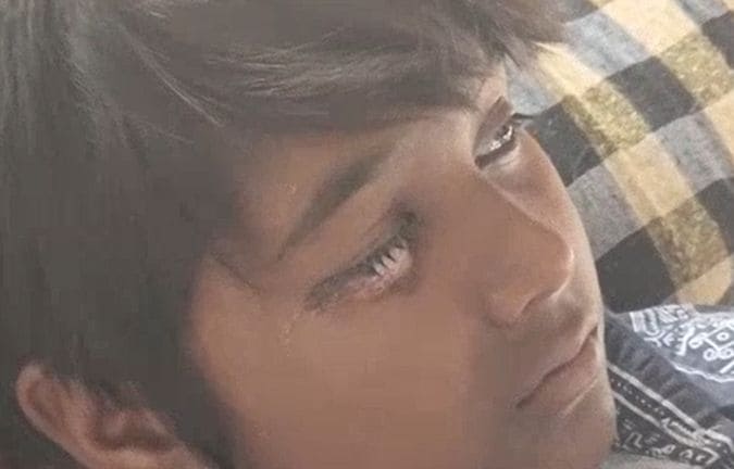 विदिशा में पटाखा गन से 14 बच्चों की आंख की रोशनी चली गई है। विदिशा में पटाखा गन से 14 बच्चों की आंख की रोशनी चली गई है।