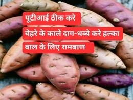 चेहरे के काले दाग-धब्बे करेगा हल्का और बालों को चमकदार, सर्दियों के इस फल में हैं जादुई गुण चेहरे के काले दाग-धब्बे करेगा हल्का और बालों को चमकदार, सर्दियों के इस फल में हैं जादुई गुण