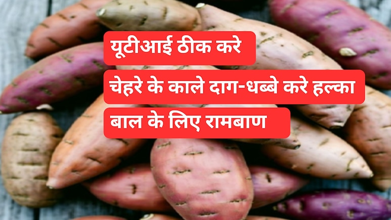 चेहरे के काले दाग-धब्बे करेगा हल्का और बालों को चमकदार, सर्दियों के इस फल में हैं जादुई गुण चेहरे के काले दाग-धब्बे करेगा हल्का और बालों को चमकदार, सर्दियों के इस फल में हैं जादुई गुण