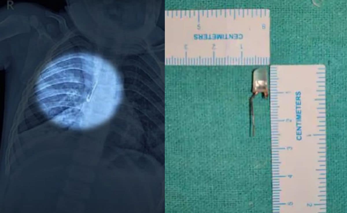 Latest and Breaking News on NDTV Latest and Breaking News on NDTV