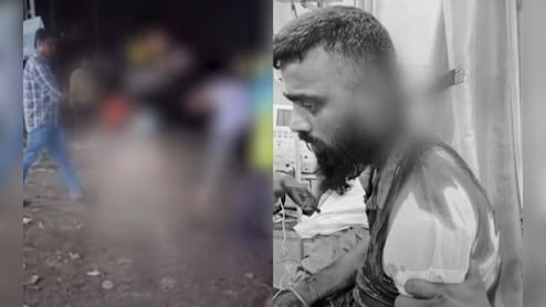 Kerala Man Stabbed During Fight, Goes To Hospital With Knife In Neck