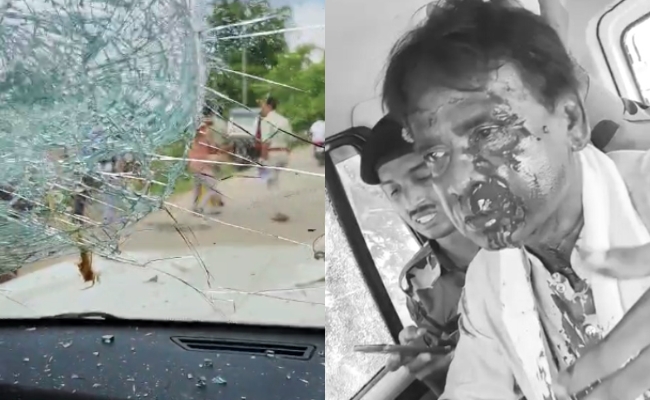 BJP MP Khagen Hit On Head, Left Bleeding After Stones Thrown In Bengal