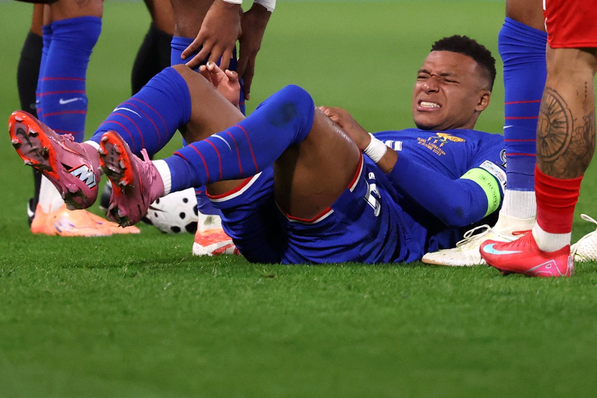 Mbappe To Miss France's World Cup Qualifier vs Iceland Due To Injury